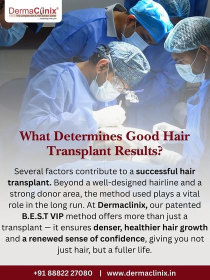 What determines good hair transplant results? Beyond a strong donor area, the method is vital. Our patented B.E.S.T. VIP method ensures denser, healthier hair growth for a renewed sense of confidence.
