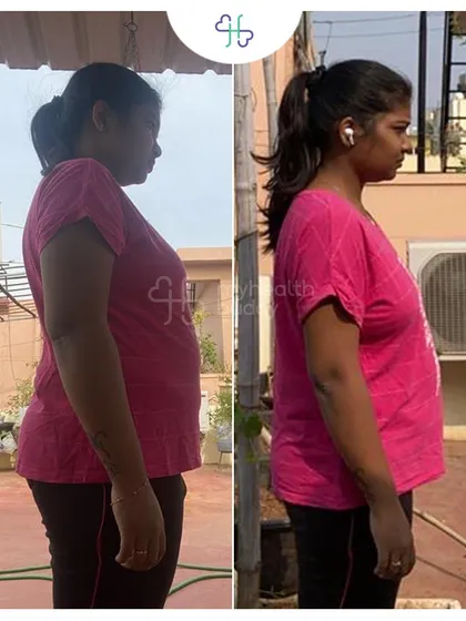 The side view of Lavanya's 12 kg weight loss journey. A clear demonstration of how a structured plan leads to visible results.