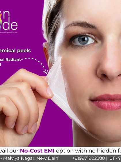 Chemical peels are a fantastic way to reveal radiant skin. This treatment effectively removes the top layer of dead skin cells to address issues like acne scars and pigmentation.