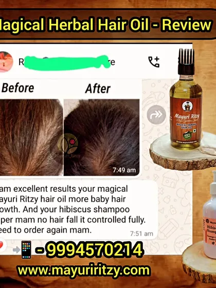 Look at the amazing baby hair growth and controlled hair fall this customer experienced. This is the result of combining my Magical Herbal Hair Oil with the gentle, effective cleansing of my Hibiscus Shampoo.