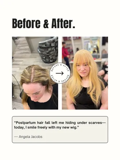 Postpartum hair fall is a difficult journey for many new mothers. Angela went from hiding under scarves to smiling freely again with her new, natural-looking blonde wig.