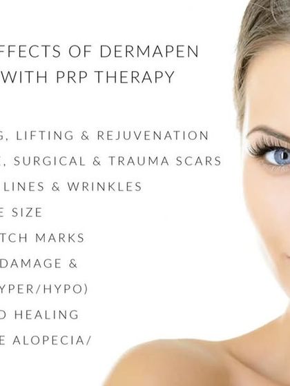 This graphic details the many benefits of Dermapen microneedling with PRP therapy, including skin tightening, scar improvement, pore size reduction, and even helping with hair loss.