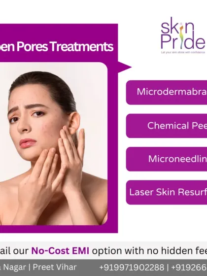 Struggling with open pores? We offer several effective treatments like microdermabrasion, chemical peels, and microneedling to refine skin texture and tighten pores.