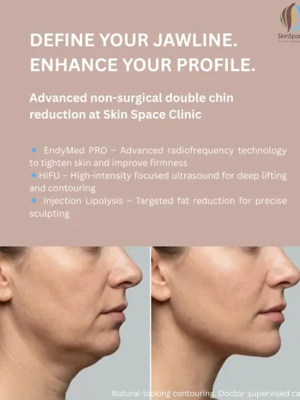 A defined jawline can transform your entire profile. We achieve natural-looking, non-surgical double chin reduction using a combination of advanced technologies. Our approach includes EndyMed PRO for radiofrequency skin tightening, HIFU for deep tissue lifting, and targeted injection lipolysis to precisely sculpt and reduce fat.