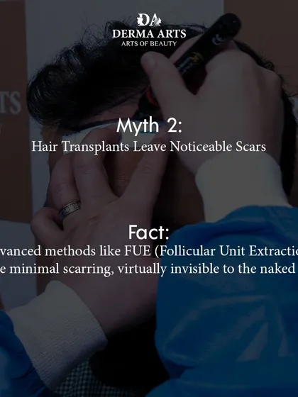 Myth: Hair transplants leave noticeable scars. Fact: Advanced methods like FUE, which I specialize in, involve extracting individual follicles, leaving behind minimal scarring that is virtually invisible to the naked eye.