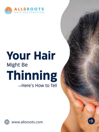 Hair thinning often starts subtly. Recognizing the early signs is crucial for effective treatment. If you notice a more visible scalp, increased hair fall, or thinning at the crown or temples, it is time to seek a professional evaluation.