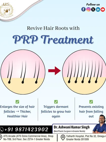 The science behind PRP is simple yet effective. It enlarges the size of hair follicles for thicker hair, triggers dormant follicles to start growing again, and helps prevent existing hair from falling out.