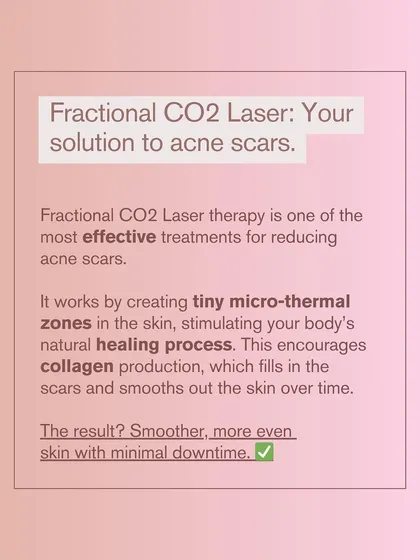 This graphic explains how the Fractional CO2 Laser works. It creates tiny micro-thermal zones, stimulating your body's natural healing process to produce collagen and fill in scars.