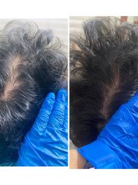 Hair & Scalp Treatments