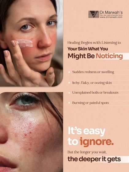 It is easy to ignore early signs of skin distress like sudden redness, itchy patches, or unexplained breakouts. However, the longer you wait, the deeper the issue can become, making it harder to treat.