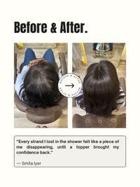 Hair Loss Solutions (Wigs & Toppers)