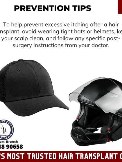 This graphic gives prevention tips for post-transplant itching, such as avoiding tight hats and following all post-surgery instructions.