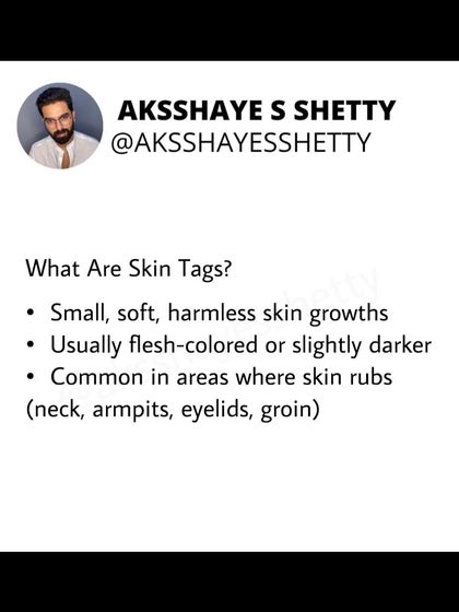 Skin tags are often harmless, but they can be a sign of underlying metabolic issues like insulin resistance. Addressing diet, exercise, and weight management can help reduce the risk of new ones forming.