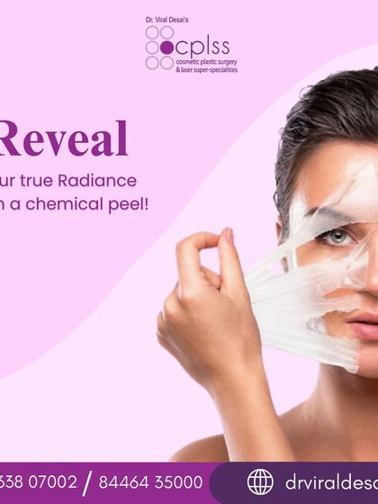 A chemical peel is a versatile treatment for improving skin texture, tone, and clarity. By exfoliating the outer layers, it can effectively address concerns like acne, hyperpigmentation, and fine lines, revealing fresher skin underneath.