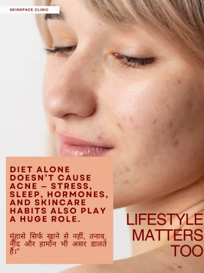 Lifestyle matters too. Diet alone doesn't cause acne. Stress, poor sleep, hormonal fluctuations, and your skincare habits all play a significant role in your skin's overall health and appearance.