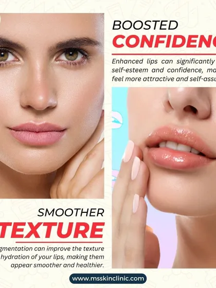 Fuller, smoother lips not only enhance your appearance but can also significantly boost your confidence. Lip augmentation improves the texture and hydration of your lips, making them look healthier and more youthful.
