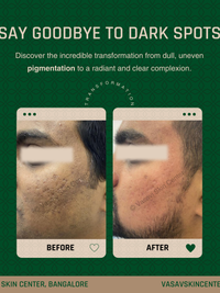 Pigmentation & Skin Brightening