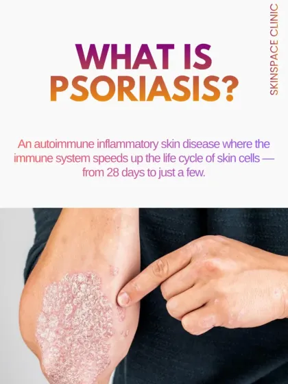 This image explains the fundamental nature of psoriasis. It is an autoimmune disease that dramatically speeds up the life cycle of skin cells, causing them to build up into the plaques you see on the skin.