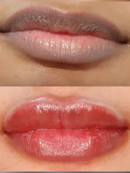 A close-up look at the power of lip blush to correct discoloration. The after photo shows vibrant, healthy, and plump-looking lips with a natural-looking tint.