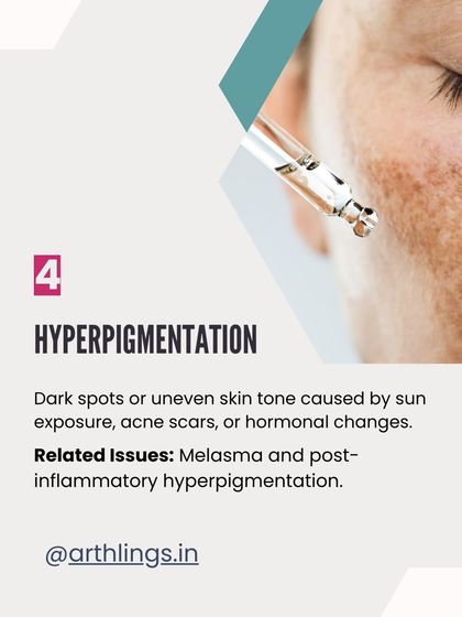 Hyperpigmentation refers to dark spots or uneven skin tone caused by sun exposure, acne scars, or hormonal changes.