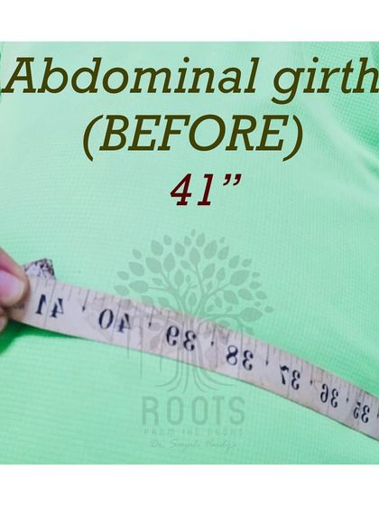 Before: The client's abdominal girth measured 41 inches at the start, a key indicator of visceral fat which we aimed to reduce.