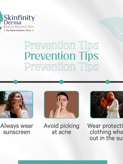 This post provides essential prevention tips for hyperpigmentation: always wear sunscreen, avoid picking at acne, and wear protective clothing when out in the sun.