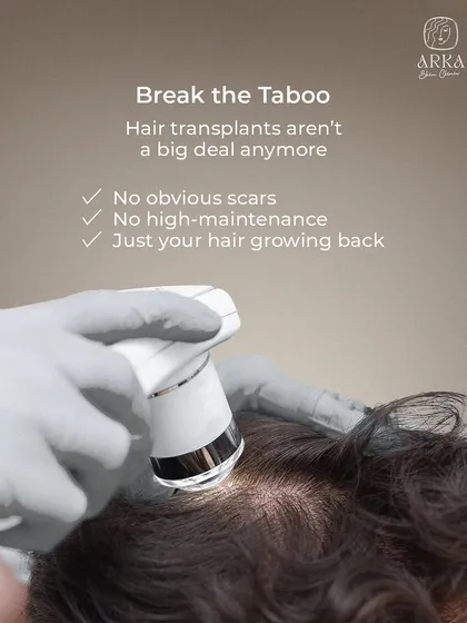 The idea of a hair transplant can be intimidating, but modern techniques have made it a straightforward procedure. With no obvious scars and no high-maintenance aftercare, it is simply about getting your own hair to grow back. We use advanced tools for a precise and comfortable experience.
