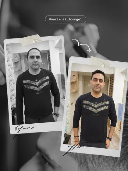 This before and after collage highlights the refining power of a custom hairpiece. It's not just about covering baldness; it's about creating a sharp, stylish look that enhances the client's features.