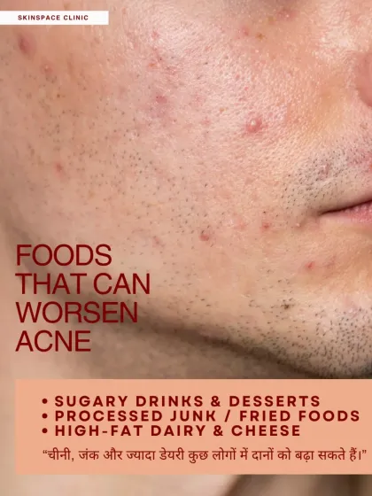 Foods that can worsen acne for some people include sugary drinks, processed junk food, and high-fat dairy. It's not the same for everyone, but being mindful of these can help manage breakouts.
