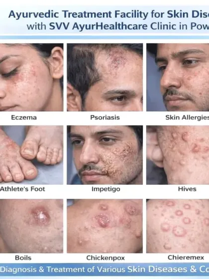 I treat a wide spectrum of skin diseases at my clinic. This collage shows some of the common conditions I can help you with, including acne, eczema, psoriasis, ringworm, and pigmentation issues like melasma. My goal is to provide an effective diagnosis and lasting treatment for your specific concern.