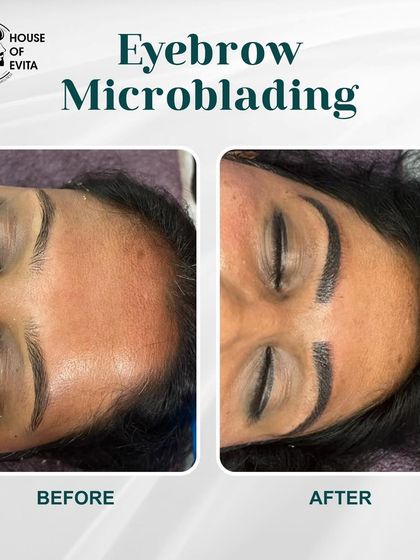 This Microblading before-and-after shows a significant enhancement in both shape and thickness, giving the client bold, beautiful brows.