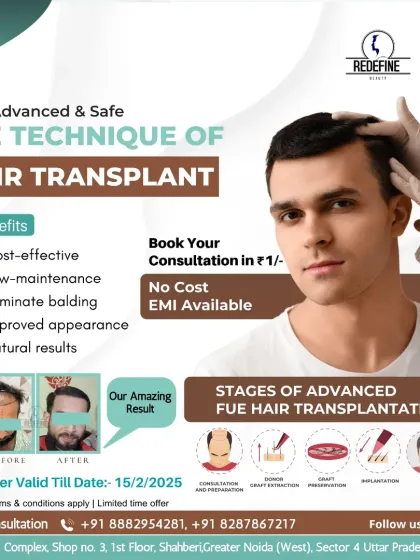 This graphic details the stages of our advanced FUE hair transplant, from the initial consultation and graft extraction to implantation and aftercare. It also showcases another one of our amazing before and after results.