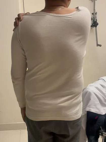 This was Mr. Deepak at the beginning of his treatment, unable to lift his arm to his shoulder due to pain and stiffness.