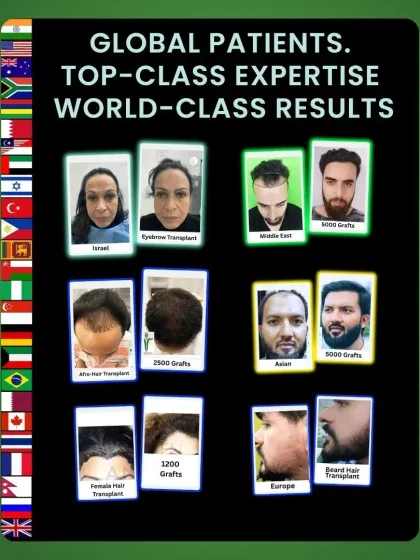 We are proud to serve a global patient base. This image shows the diversity of our clients and the world class results we deliver, from scalp transplants to eyebrow and beard restoration.