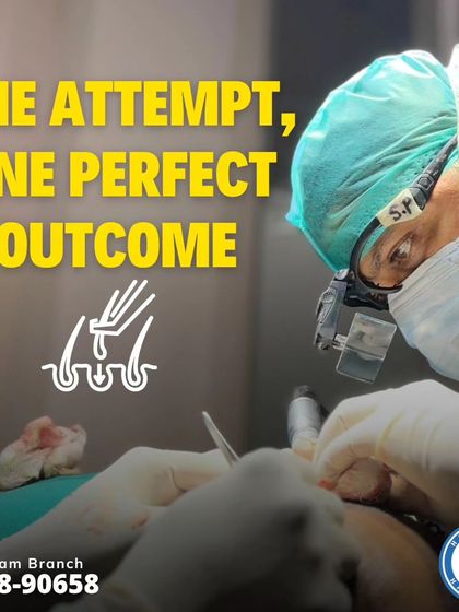 One attempt, one perfect outcome. This image captures the concentration required during an FUE procedure. Choosing an experienced surgeon is the most critical decision you will make.