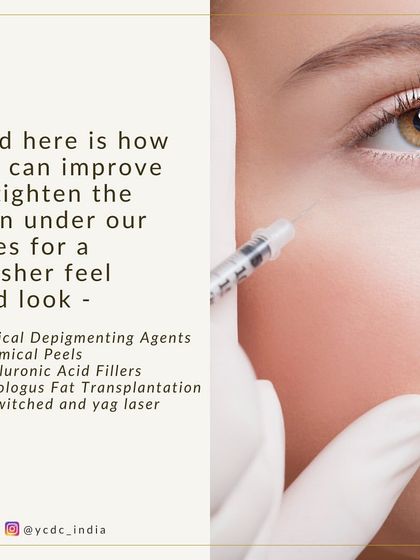 We can improve and tighten the skin under the eyes using various methods. Our solutions include topical agents, chemical peels, hyaluronic acid fillers, and advanced laser treatments.