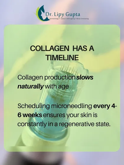 Collagen production naturally slows with age. Scheduling microneedling every 4-6 weeks keeps your skin in a constant regenerative state to counteract this process.