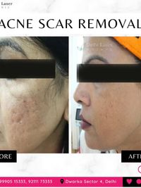 Skin & Scar Correction Treatments