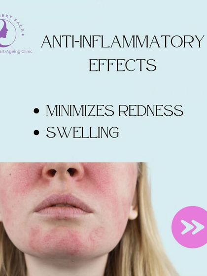 Clinic Next Face - Advanced Skin Treatments Skin Resurfacing & Repair photo 13