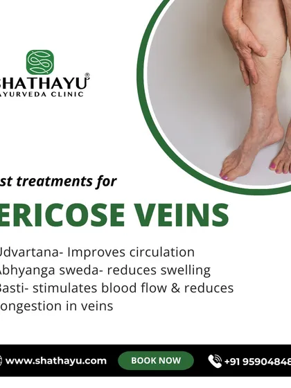 Varicose veins are not just a cosmetic issue; they can cause pain and discomfort. I use a combination of therapies like Udwartana to improve circulation, Abhyanga Sweda to reduce swelling, and Basti to clear congestion, addressing the condition from its root.