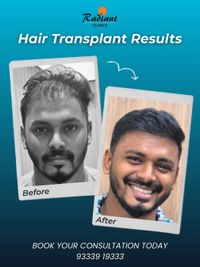 Hair Transplant