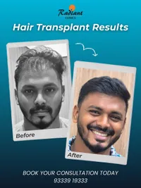 Hair Transplant