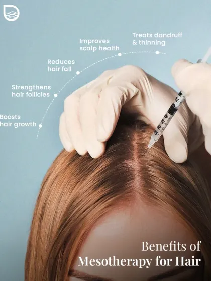 Mesotherapy is another powerful tool I use to combat hair loss. This graphic illustrates its key benefits, from boosting growth and strengthening follicles to reducing hair fall and improving overall scalp health by treating issues like dandruff.