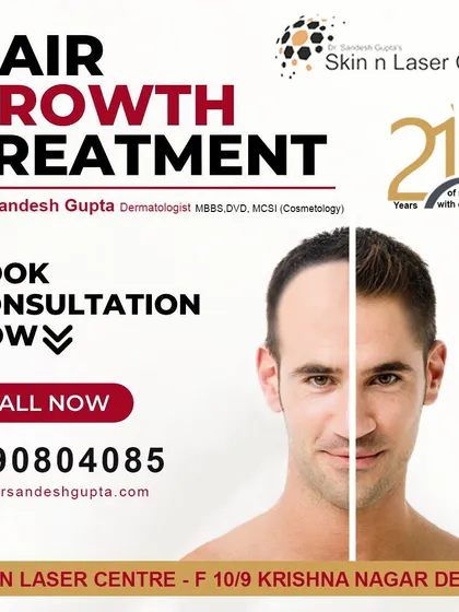This before-and-after comparison highlights the significant change possible with a hair growth treatment plan, restoring a youthful and fuller hairline.