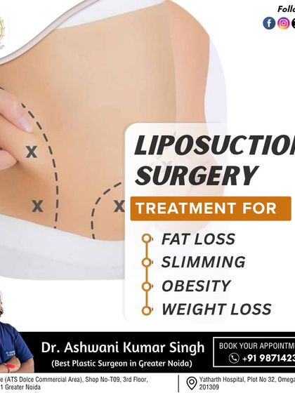 Liposuction is an effective surgical treatment for fat loss and slimming in targeted areas. It is a body contouring tool, not a solution for general obesity, but it can dramatically improve your shape.