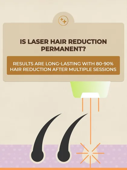 One of the most common questions we get is about permanence. Our laser hair reduction treatment delivers long-lasting results, with most clients seeing an 80-90% reduction in hair growth after completing their recommended sessions.