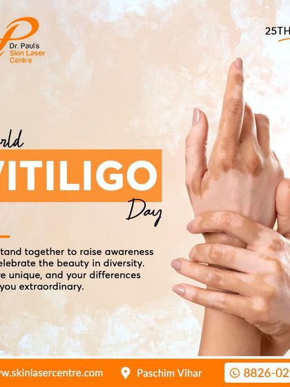 On World Vitiligo Day, we stand together to raise awareness and celebrate the beauty in diversity. Your differences are what make you extraordinary, and I am here to support you on your journey.