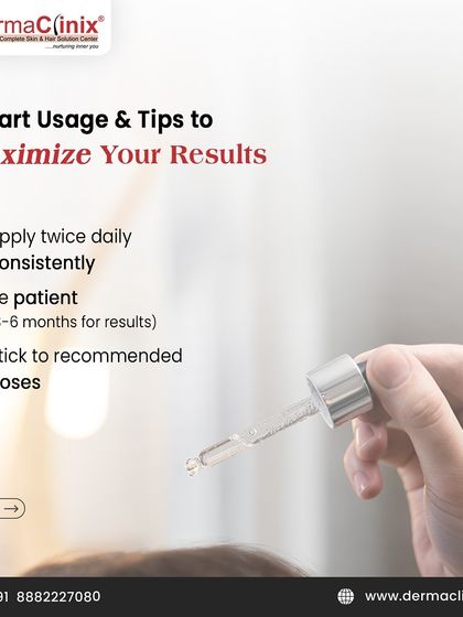 To maximize your results with topical Minoxidil, apply it twice daily, be patient as results can take 3-6 months, and stick to the recommended doses.