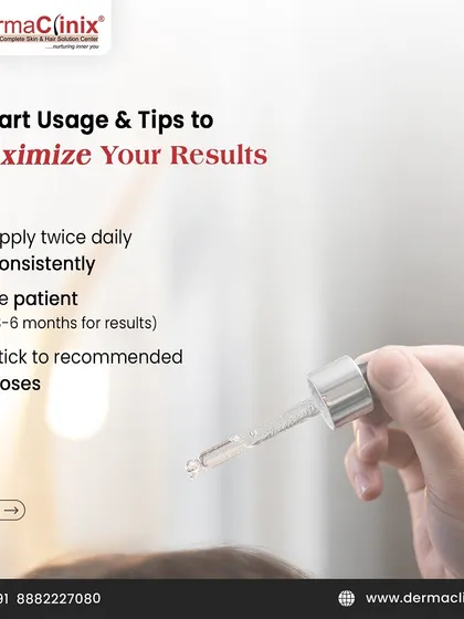 To maximize your results with topical Minoxidil, apply it twice daily, be patient as results can take 3-6 months, and stick to the recommended doses.