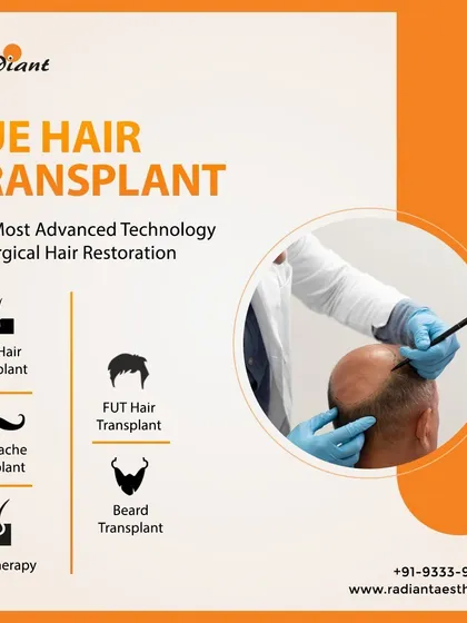 My primary technique is Follicular Unit Extraction, or FUE. This graphic provides a simple overview of the services I offer, from FUE for the scalp and beard to specialized moustache transplants. It is the most advanced method for surgical hair restoration.